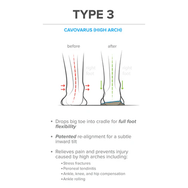 Foot Scientific Arches Type 3 Supination/High Arch Orthotic (Unisex) Accessories - Orthotics/Insoles - Full Length - The Heel Shoe Fitters